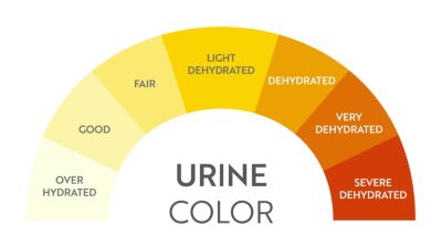 Warna Urine: Kenali Tanda Dan Artinya