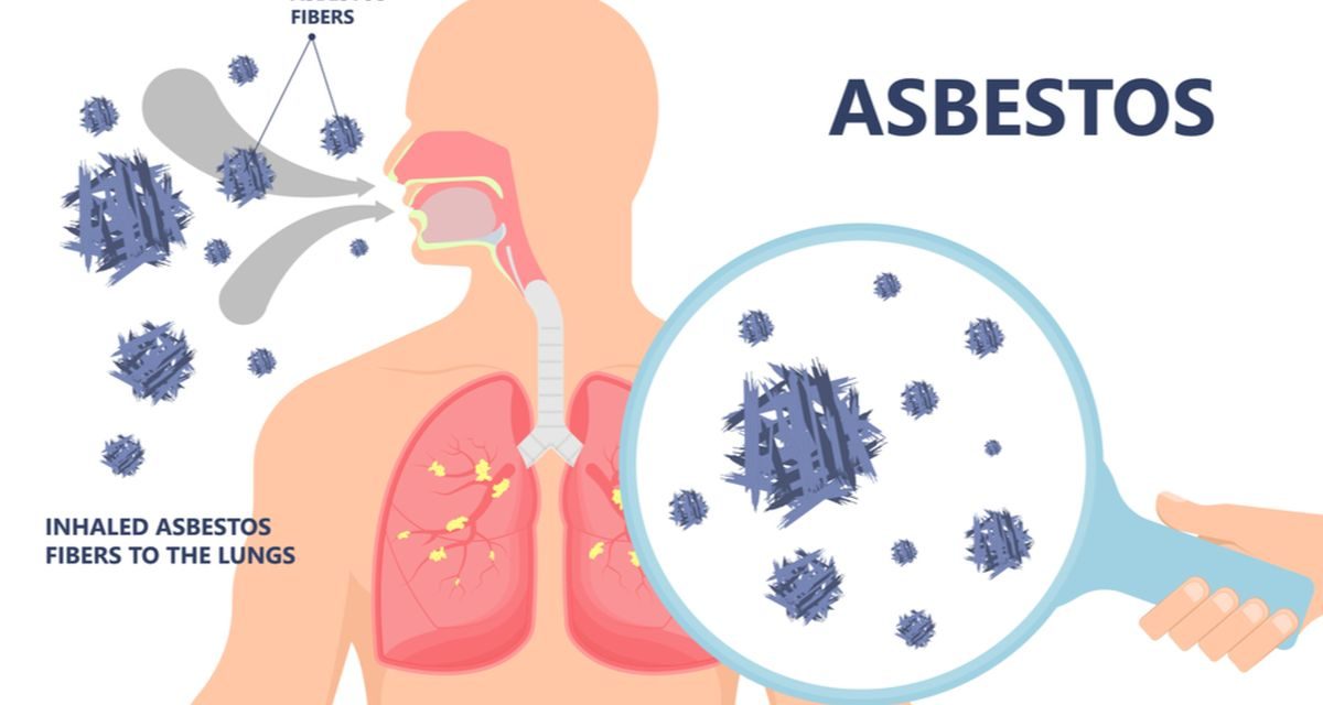 Asbestosis Penyakit Paru Akibat Paparan Asbes Perlu Di Waspadai