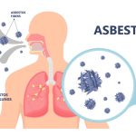 Asbestosis Penyakit Paru Akibat Paparan Asbes Perlu Di Waspadai