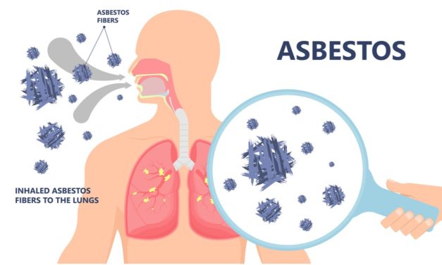 Asbestosis Penyakit Paru Akibat Paparan Asbes Perlu Di Waspadai