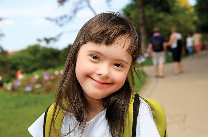 Down Syndrome
